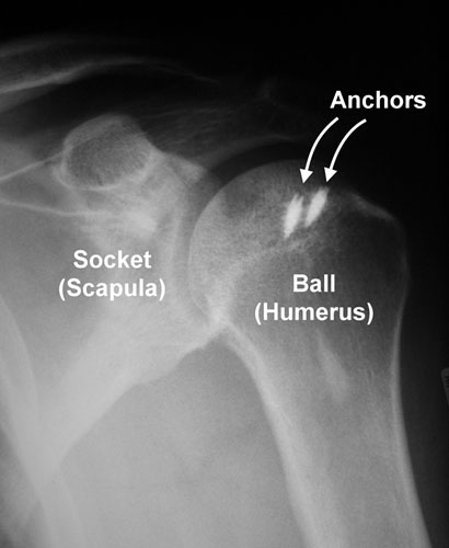 shoulder 12 diagram