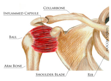 shoulder 16 diagram