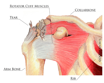 shoulder 4 diagram picture