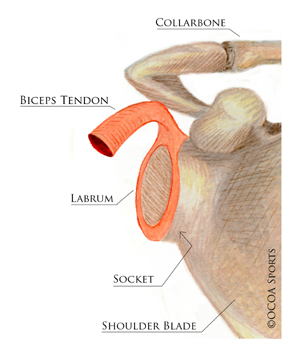 Shoulder Stabilization Surgery