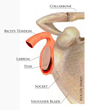 Shoulder Dislocations 4