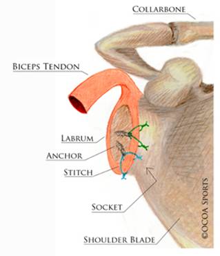 Shoulder Dislocations 8