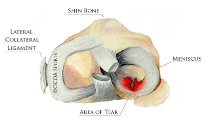 knee 14 diagram