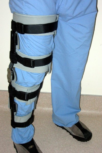 knee brace diagram