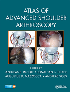 atlas of advanced shoulder arthoscopy