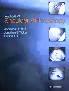 shoulder arthroscopy