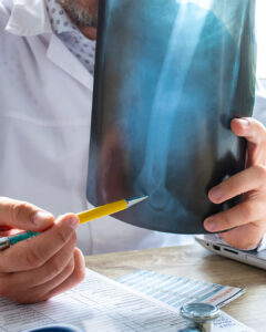 A doctor in a white coat points at an X-ray with a yellow pencil, examining a bone. A clipboard with medical records and a stethoscope are on the table. The focus is on the X-ray and the doctor's hand.