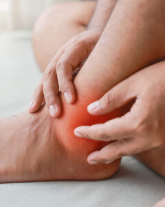 A person holding their ankle with both hands. The skin around the ankle is red, indicating pain or inflammation.